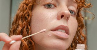 Як позбутися прищів: дієві засоби та поради для чистої шкіри